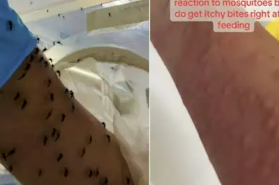 팔뚝에 ‘모기 떼’가 시커멓게 우르르…호주 실험실 ‘먹이’ 주는 방법 봤더니