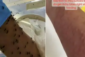 팔뚝에 ‘모기 떼’가 시커멓게 우르르…호주 실험실 ‘먹이’ 주는 방법 봤더니