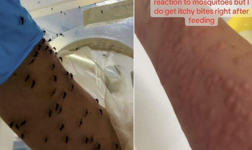 실험실 모기에게 직접 팔을 내민 호주 연구원. 수십 마리가 피를 빨아먹는 장면이 소셜미디어(SNS)에서 화제를 모았다. SNS 캡처