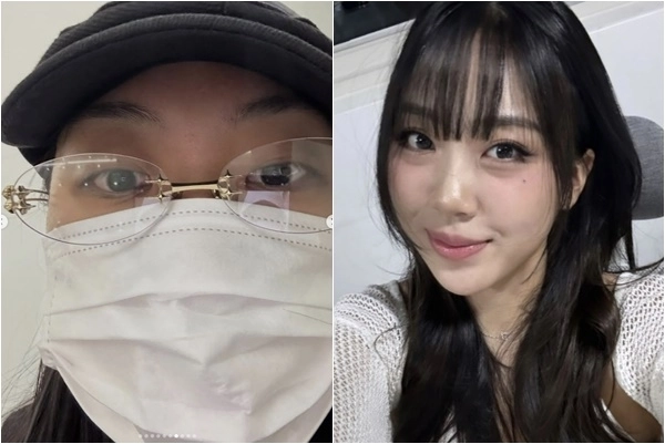 래퍼 이영지가 눈밑지방재배치 수술을 했다고 고백했다. 이영지 인스타그램 캡처