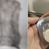 thumbnail - “자궁 시술 후 몸속에서 거즈 나와”…산부인과 의사 “제거 깜빡” 인정에도 ‘무혐의’