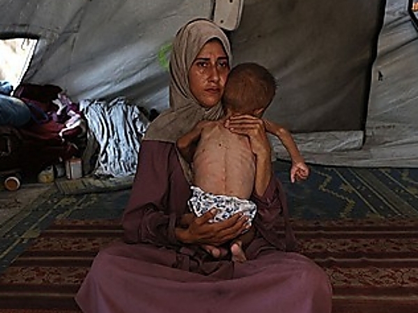 뼈가 앙상한 아기 안고 있는 가자지구의 한 주민. AFP연합뉴스