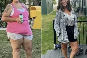“같은 사람 맞아?” 30대 비만女, 식단에 ‘이것’ 추가했더니 체중 ‘뚝’…“72㎏ 감량