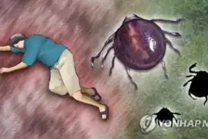 경북 올 첫 SFTS 확진…치명률 높은 진드기 감염병 ‘비상’