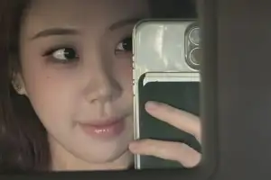 thumbnail - 성형 4년 고민했다던 이영지, 수술 대박 난 근황