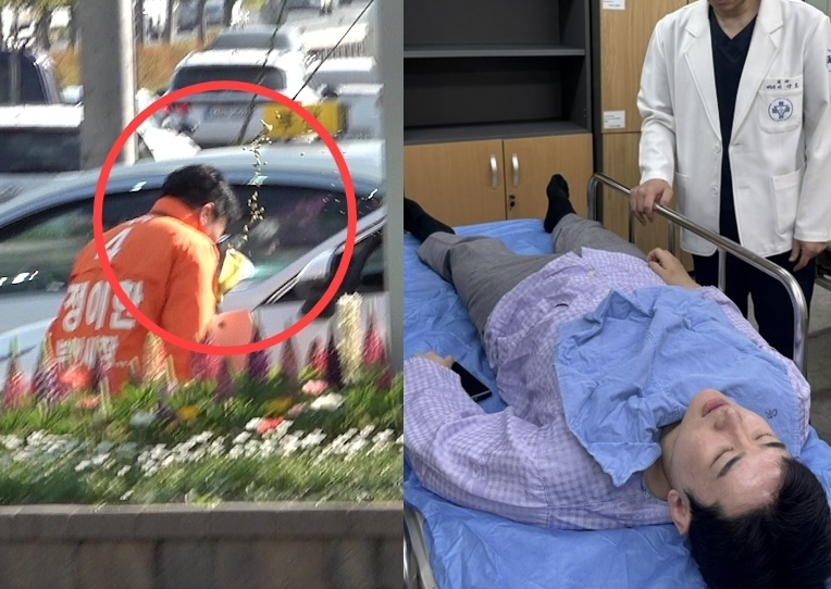 정이한 개혁신당 부산시장 후보가 27일  부산 금정구 구서나들목 주변에서 유세하던 도중 한 시민이 던진 음료가 담긴 컵에 맞았다.(왼쪽) 정 후보는 인근 병원으로 후송돼 치료받았다. 개혁신당 선대위