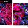 “암 발생 전부터 몸은 암세포 성장 최적 환경으로 변한다”