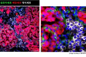 “암 발생 전부터 몸은 암세포 성장 최적 환경으로 변한다”