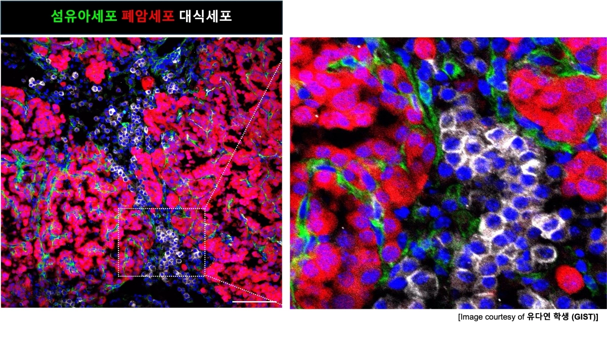 초기 폐암에서 돌연변이 줄기세포가 주변 환경을 바꾸는 과정도. GIST 제공