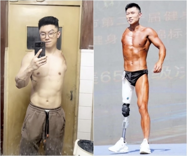 중국에서 한쪽 팔과 한쪽 다리를 잃은 남성이 보디빌딩 대회에 출전해 많은 이들에게 감동을 주고 있다. SNS 캡처