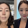 “이거 맞아?” 38세 유이, 중국 가더니 얼굴이… 본인도 놀란 외모 근황