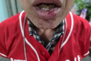 “빨간 옷 보자마자…” 국힘 대구 구의원 선거운동원 폭행한 60대 검거