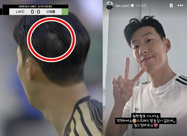 축구 국가대표팀 주장 손흥민(LA FC)이 지난 25일(현지시간) 미국 캘리포니아주 로스앤젤레스(LA) BMO 스타디움에서 열린 시애틀 사운더스와의 2026 미국프로축구(MLS) 15라운드 홈 경기에서 그라운드를 누빈 가운데, 카메라에 포착된 손흥민의 뒷통수를 본 팬들이 “원형 탈모 아니냐”는 의문을 제기했다.(왼쪽) 이에 손흥민은 자신의 소셜미디어(SNS)를 통해 “탈모가 아니다”라고 해명했다. 자료 : 쿠팡플레이·손흥민 인스타그램