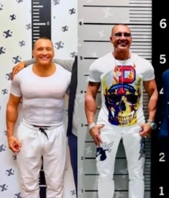 미국의 한 남성이 키를 175㎝에서 183㎝로 늘리는 사지연장술을 받았다. 메트로 캡처