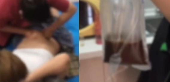 중국 베이징에서 건강관리센터를 운영하며 노인들에게 ‘장 해독 치료’를 해준다며 거액을 가로챈 일당이 적발됐다. 중국 시나재경 영상 캡처