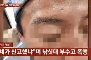 thumbnail - “네가 신고했지”…데이트 폭행 신고했다가 보복 폭행 당해