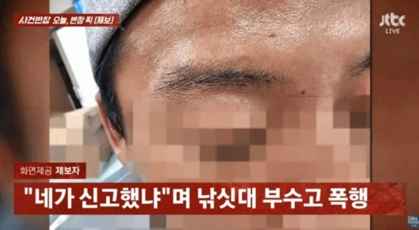 폭행 현장을 신고했다가 오히려 가해 남성에게 보복 폭행을 당했다는 사연이 전해졌다. JTBC ‘사건반장’ 캡처