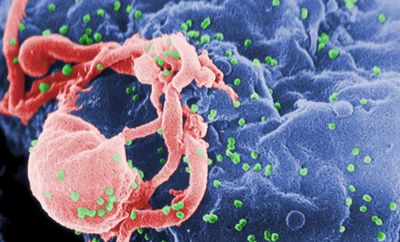 인체면역결핍바이러스(HIV) 관련 이미지. 위키피디아