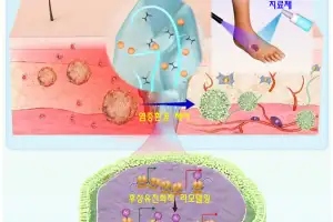 단국대 연구팀, 스프레이형 당뇨병 만성 상처 치료제 개발