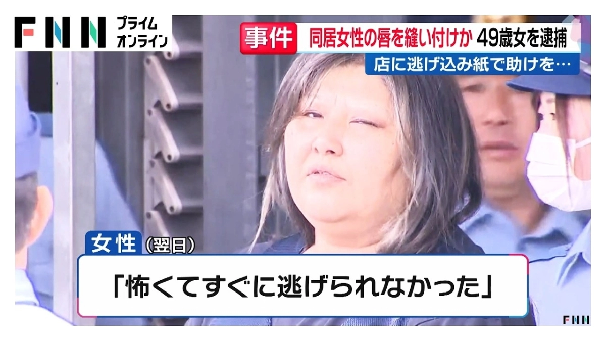 함께 사는 여성의 입술을 꿰맨 혐의를 받는 사쿠라이 마사에(49). FNN 유튜브 캡처