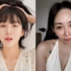 thumbnail - AOA 출신 권민아, 얼굴 달라졌나…의료사고 후 근황 thumbnail - AOA 출신 권민아, 얼굴 달라졌나…의료사고 후 근황