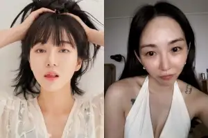 AOA 출신 권민아, 얼굴 달라졌나…의료사고 후 근황 [SNS★샷]
