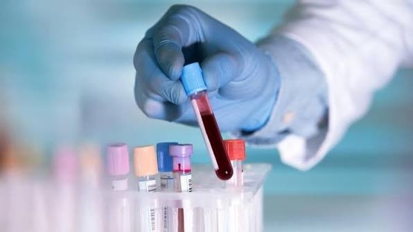 혈액 검사 한 번 만으로 대장암 환자의 예후를 정확하게 진단하고 예측할 수 있는 방법이 개발됐다.  미국 국립보건원(NIH) 제공