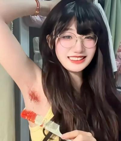중국의 젊은 여성들 사이에서 겨드랑이털을 분홍색, 파란색 등 화려한 색상으로 염색해 소셜미디어(SNS)에 인증하는 트렌드가 확산하고 있다. SCMP