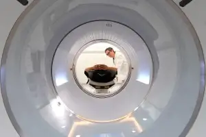 단국대병원, AI 디지털 PET-CT 도입…방사선 피폭 최소화 등 효과