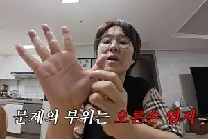 thumbnail - “최근 글 못 썼다”는 송은이, 염증 범벅에 결국 수술…손가락 ‘딸깍’하는 ‘이 질환’ 뭐