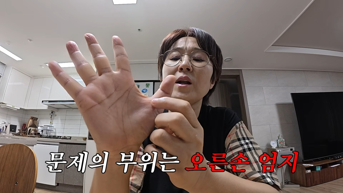 방송인 송은이가 최근 ‘방아쇠 수지 증후군’으로 수술을 받은 근황을 공개했다. 유튜브 채널 ‘VIVO TV - 비보티비’ 캡처