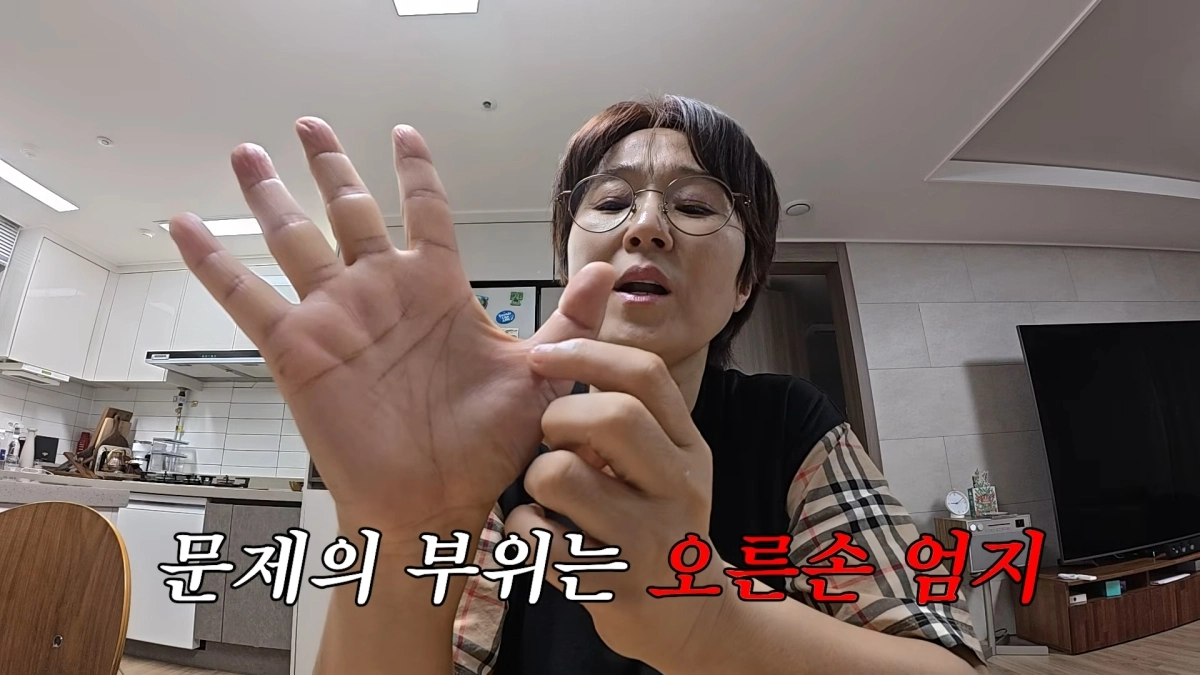 방송인 송은이가 최근 ‘방아쇠 수지 증후군’으로 수술을 받은 근황을 공개했다. 유튜브 채널 ‘VIVO TV - 비보티비’ 캡처
