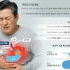 thumbnail - 추석 과식 후 ‘쓰린 속’… 잠들기 3시간 전엔 숟가락 놓으세요