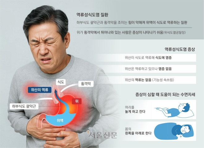 추석 과식 후 ‘쓰린 속’… 잠들기 3시간 전엔 숟가락 놓으세요
