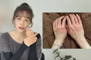 윤은혜, “손 붉어지더니 붓기 시작”…알고 보니 심각한 반응 [셀럽 건강]
