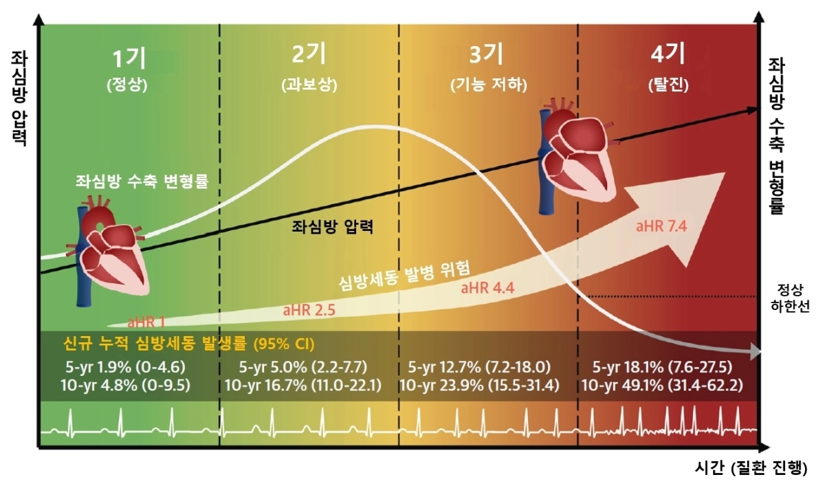 비후성 심근병증 환자에서 좌심방 병태생리에 대한 도식