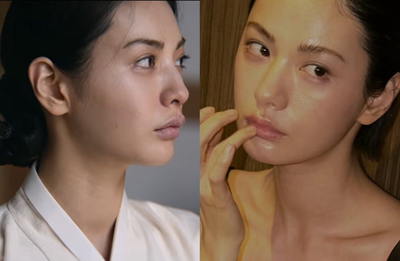 image - 나나, 입술 필러 뺐나…논란 후 “입술만 보게 되네” [SNS★샷]