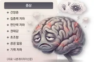 자도 자도 천근만근… 지친 뇌가 보내는 SOS 신호