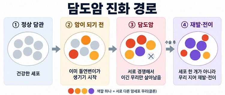 색깔이 다른 원은 서로 다른 암세포 무리를 뜻하며, X는 경쟁에서 밀려 사라진 무리다. 수술 후 재발·전이도 세포 한 개가 아닌 여러 세포 무리가 함께 일으킨다.