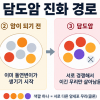 담도암 발생부터 재발·전이까지, ‘암 진화 경로’ 규명