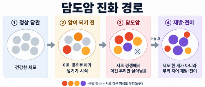 담도암 발생부터 재발·전이까지, ‘암 진화 경로’ 규명