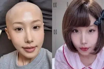 25세 유명 인플루언서, 위암 사망…“밀크티 끊었어야 했어” 뼈저린 후회
