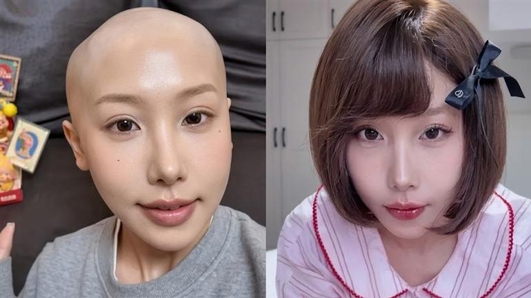 위암으로 숨진 중국 인플루언서 고(故) 쉬바오 시시의 생전 모습. 소셜미디어(SNS) 캡처