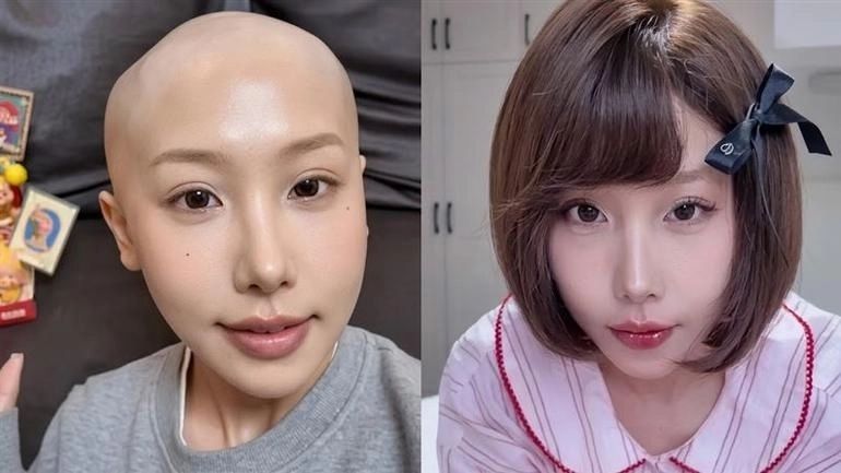 위암으로 숨진 중국 인플루언서 고(故) 쉬바오 시시의 생전 모습. 소셜미디어(SNS) 캡처