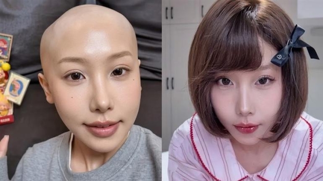 25세 유명 인플루언서, 위암 사망…“밀크티 끊었어야 했어” 뼈저린 후회 [월드픽]