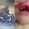 thumbnail - “딸아이 피 철철 흐르는데 도망간 외국인”…잡고 보니 마약사범이었다