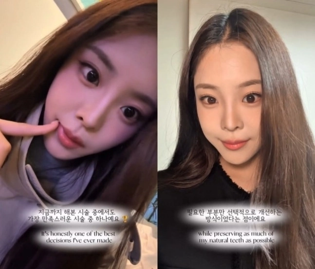 2026 미스코리아 진 우서윤. 자료 : 우서윤 SNS