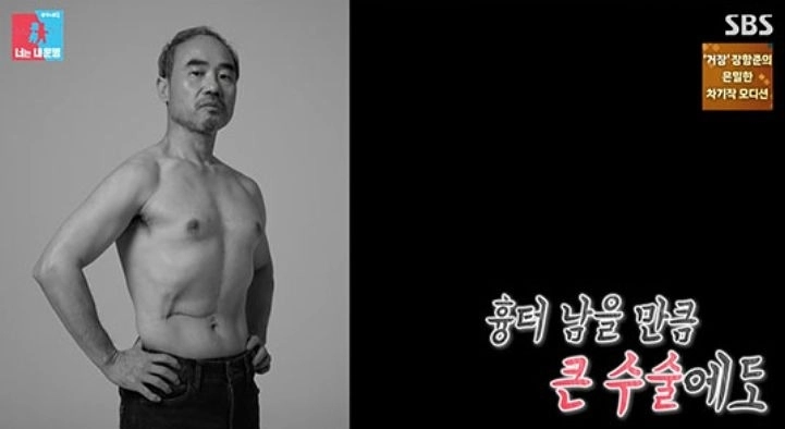 배우 강신일이 간암 진단을 받고 수술한 지 2주 만에 활동을 재개해야만 했던 사연을 털어놨다.  SBS ‘동상이몽 2-너는 내 운명’ 캡처