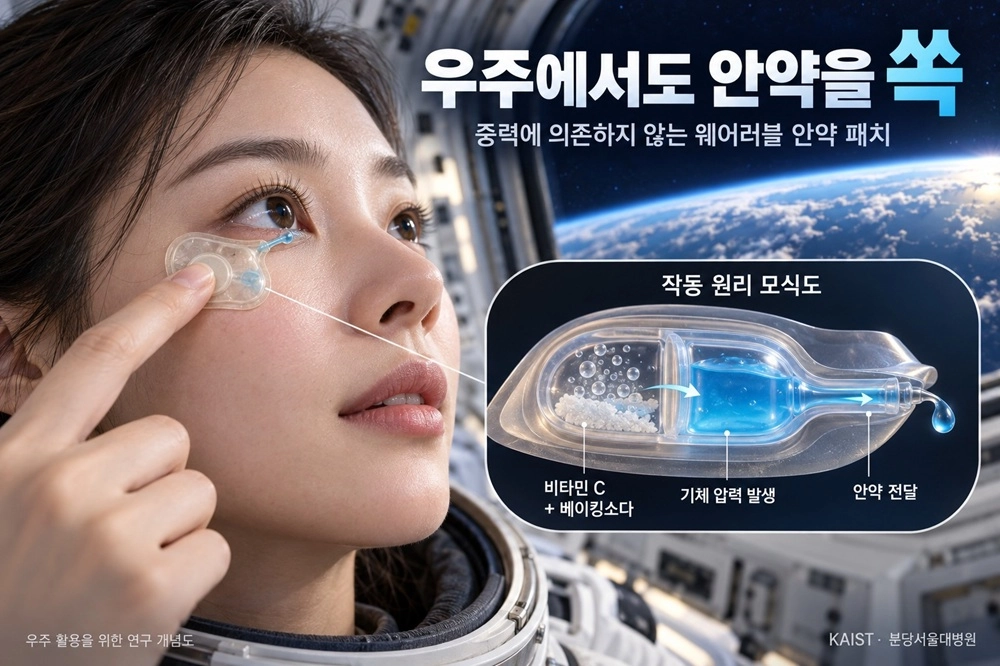 웨어러블 안약 개념도. 카이스트 제공
