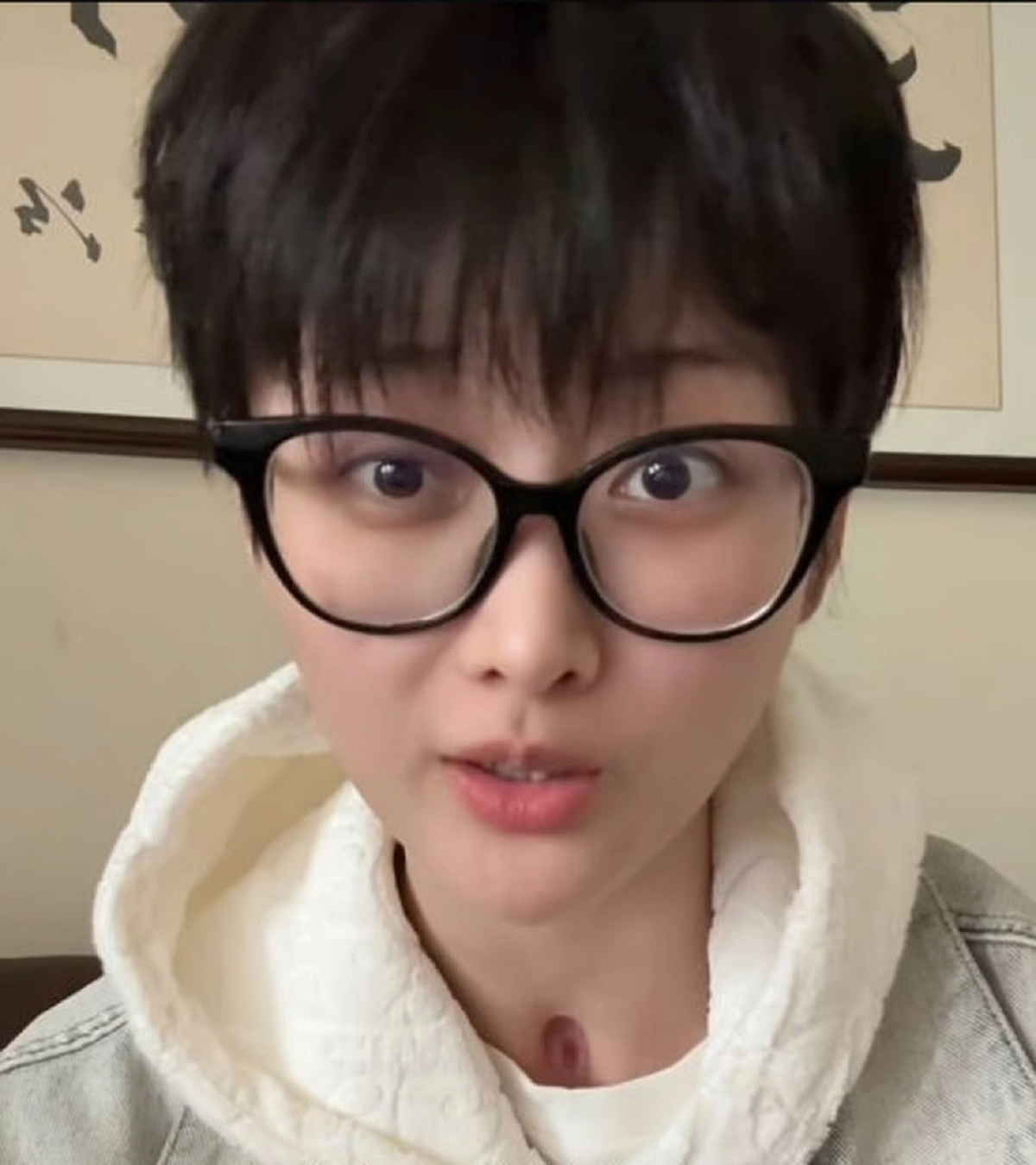 와나난은 사고 이후 약 17개월 만에 올린 복귀 영상에서 근황을 전했다. 163.com 캡처